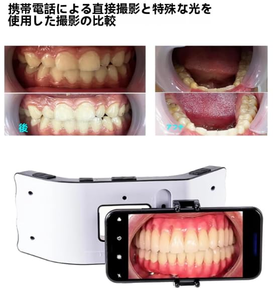 Amazon.co.jp: JoyeeLii モバイル歯科撮影ライト 口腔内モバイルカメラ