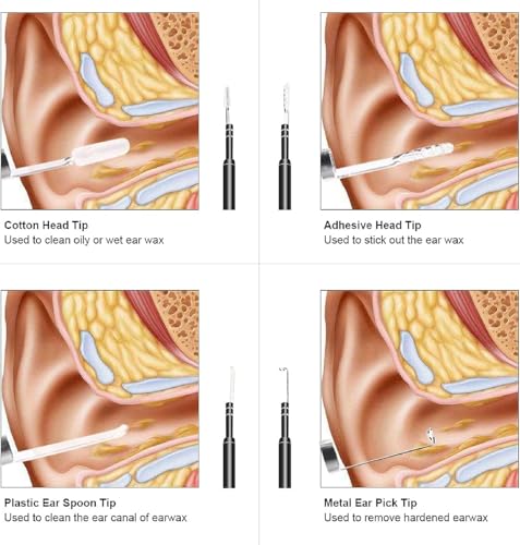 Image of Ear Otoscope, 3 in 1 Ear Endoscope, USB Digital Ear Camera Ear Wax Removal Tool with Waterproof Camera with 6 Adjustable LED Lights for Android Phone Window Mac PC