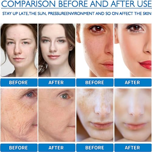 Niacinamide 10%+Zinc 1%,Hyaluronic Acid 2% + B5,Niacinamide Serum for Anti Aging,Face Moisturizer Set,Hyalu B5 Serum,Hyaluronic Acid Serum,Facial Serum to Control Excess Oil&Tackles Blemishes (2PCS) Niacinamide 10%+Zinc 1%,Hyaluronic Acid 2% + B5,Niacinamide Serum for Anti Aging,Face Moisturizer Set,Hyalu B5 Serum,Hyaluronic Acid Serum,Facial Serum to Control Excess Oil&Tackles Blemishes (2PCS)