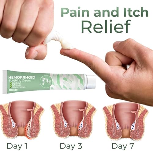 Theranal Aambeienzalf (plaatselijk verdovend) – 35 g - View 2