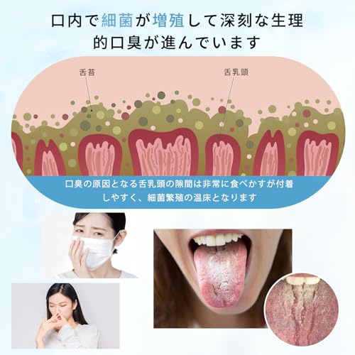 Gegoup 舌ブラシ 舌磨き ブラシ 舌クリーナー 3効果 口臭ケア 多機能 舌苔 除去 低刺激 口臭対策 口臭予防 人間工学設計 防滑グリップ 嘔吐反射防止 歯科専売品 携帯用 家庭用 の商品画像 2
