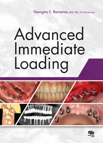 Advanced Immediate Loading