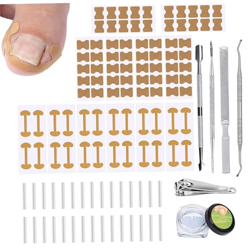 Kit de retrait d'ongles incarnés 18 pièces professionnel correcteur d'ongles incarnés avec bandes efficaces pour les soins à domicile