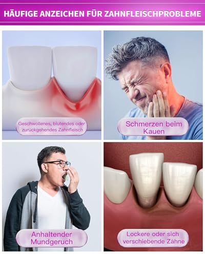 CAREDO Zahnpasta zur Behandlung von Parodontitis, Repariert Zahnfleischrückgang bei Erwachsenen, Hydroxyapatit-Zahnpasta, Fluoridfrei, Minzgeschmack, 100g Pro Tube – Bild 5