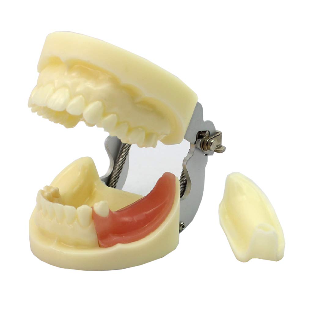 Sjdopulse Implant Teeth Model - Replaceable Dental Teeth Model - Adult Standard Orthodontic Oral Tooth Demonstration Model For For Dentist Student Children