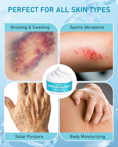 XUEBEIK Arnica Bruise Cream with Vitamin K, Non-Greasy for Thin Skin, 6 oz — view 4