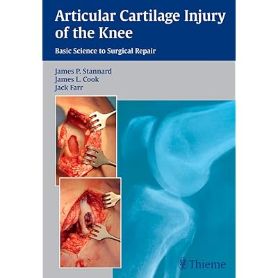 Articular Cartilage Injury of the Knee
