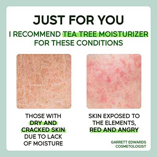 Neclar - Tea Tree Face Moisturizer For Dry Skin - Face Cream For Woman And Men - Anti-Aging Facial Skin Care Product - Cica Facial Moisturizer - Acne Cream For Face - Face Lotion For Dry Skin #TOP2