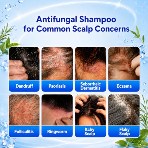 Image of ProBliva Balanced Antifungal Shampoo - Scalp Treatment for Seborrheic Dermatitis, Dandruff, Flakes, Itch & Dryness - Zinc Pyrithione 1% & Salicylic Acid 2% Dual-Action for Fungus & Buildup (8.4 fl oz)