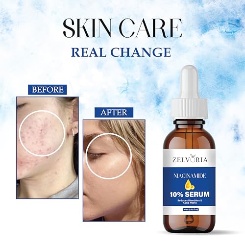 Image of 10% Niacinamide Face Serum with Hyaluronic Acid, Vitamin C & E | Brightening, Hydration & Oil Control | Reduces Acne Marks & Pores | Serum for Men & Women | Suitable for All Skin Types (30ML)