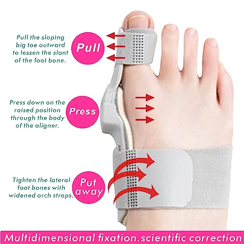 Ashomie All New Generation Bunion Corrector For Women&Men Toe Separator & Straightener For Bunion Pain Relief- Big Toe Spacer Brace Don't Wear Shoes (Blue 1Pc) #TOP1