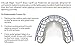 Orthodontic Braces Lip Guard Protector Shield (1 Set - Upper - Lower Teeth) with Instructions by AdentalZ