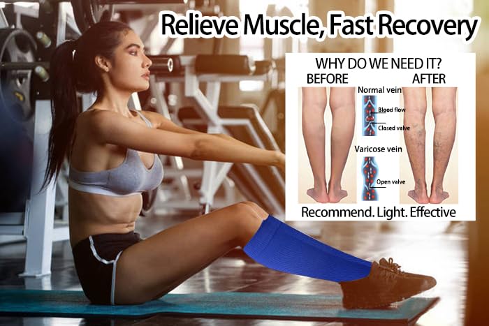 Image of Open Toe Compression Socks 2 Pairs 15-20mmHg Support Circulation Medical Toeless Compression Socks Recovery Varicose Veins