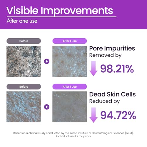 Image of Papa Recipe Eggplant Enzyme Powder Cleanser (1.7oz /50g) - Travel-Friendly Korean Enzyme Powder-to-Foam Face Wash, Oil-Moisture Balance, Hydrating, Gentle Exfoliation, Smooth Texture & Pore Care