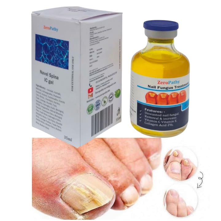 Image of Ayurveda-Infused Nail Recovery Cream for Pitted, Cracked, or Infected Nails | Deep Moisturizing Formula with Herbal Oils | Promotes Nail Growth and Strength | Safe for All Ages and Unisex Use