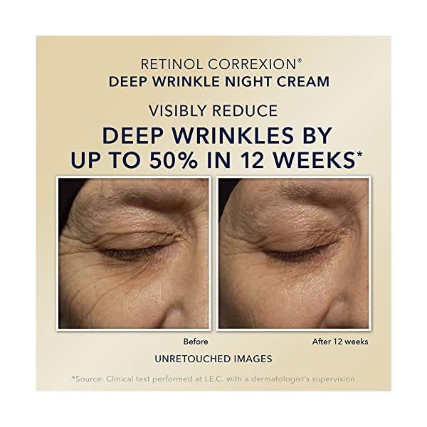 Roc-Retinol-Value-Set-Duo-Deep-Wrinkle-Night-Face-Cream-and-Retinol-Correxion-Eye-Cream-Packaging-May-Vary RoC Retinol Correxion Value Set Duo, Deep Wrinkle Anti-Aging Night Face Cream + Daily Under Eye Cream for Dark Circles & Puffiness, Moisturizer, Christmas Gifts & Stocking Stuffers for Women and Men