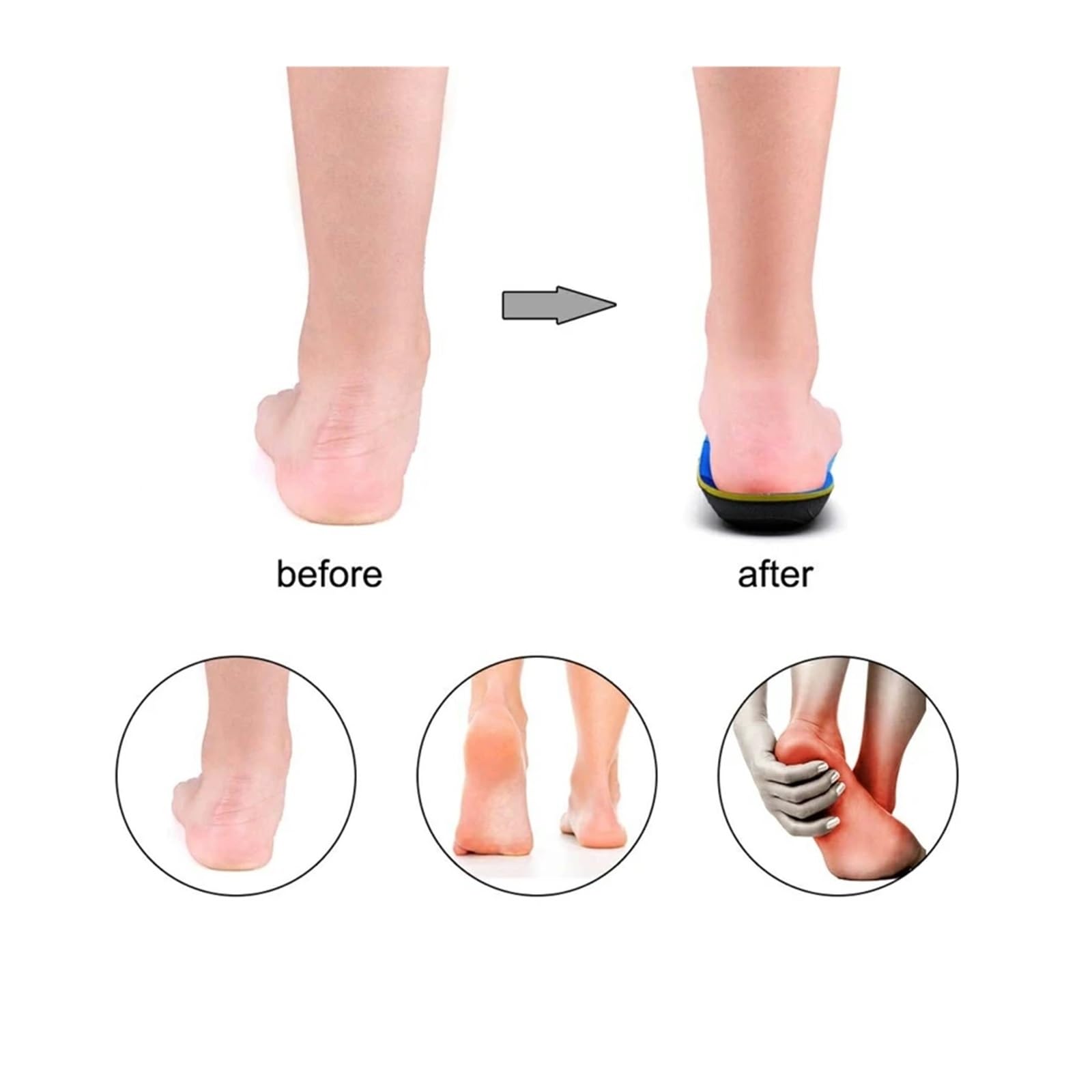 Solette Ortopediche Piedi piatti Solette ortopediche Modello di supporto for arco plantare Plantari Inserti for dolore al tallone Stivali Sneaker Uomo Donna