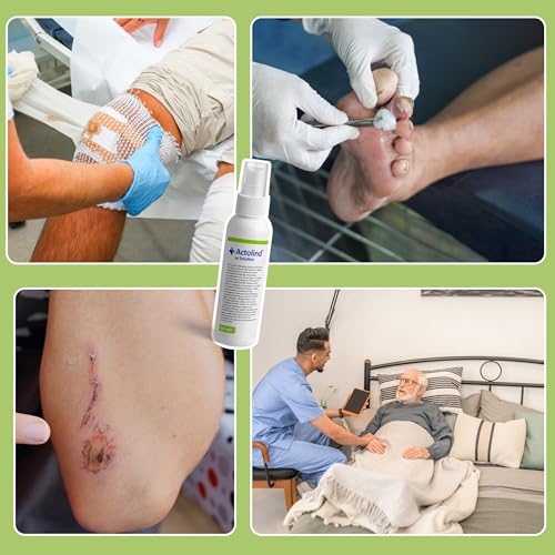 Actolind w Solution 250 ml Antiseptische Wundspüllösung in Sprühflasche Schmerzfreie Reinigung, Spülung und Befeuchtung von akuten, chronischen und infizierten Wunden & Verbrennungen PHMB PZN:10985416