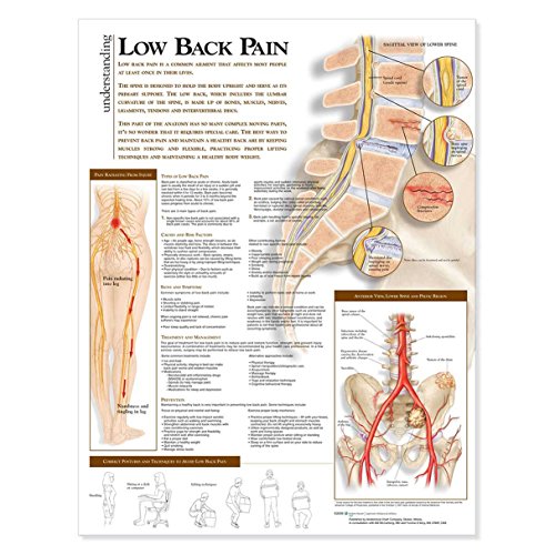 Understanding Low Back Pain Anatomical Chart