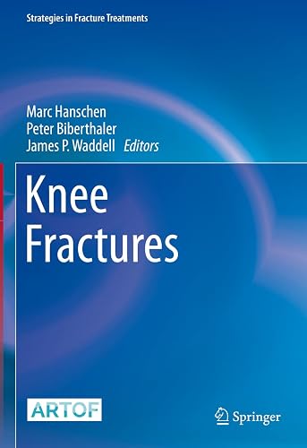 Knee Fractures (Strategies in Fracture Treatments)