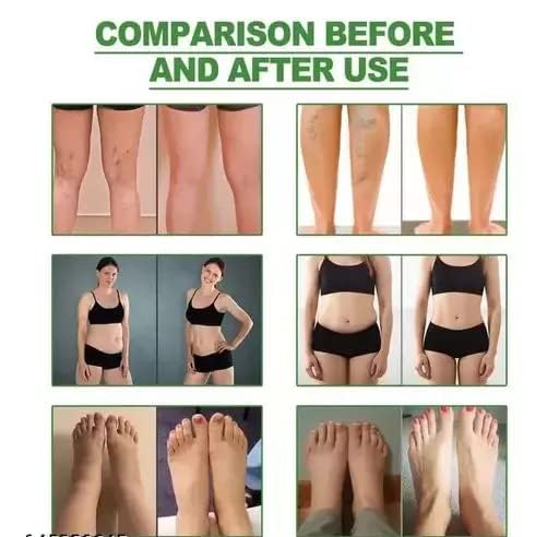 KD ZONE Ginger Foot Patch, 20 PCS Self Adhesive Foot Pads for Overnight Foot Care, Comfortable Foot Patch for Daily Wellness, Relaxing Foot Care Pads for Men & Women 3