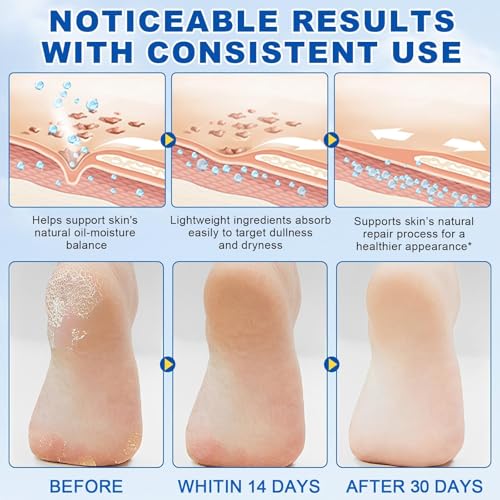 QVCQ 60% Urea Stick with 2% Salicylic Acid, Maximum Strength Callus Remover & Cracked Heel Repair Balm, Non-Greasy Foot Moisturizer for Dry Skin, 1.41 Oz (1pcs)