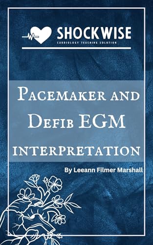 Pacemaker and defibrillator EGM interpretation (Pacemaker and Defibrillator Education Book 1)