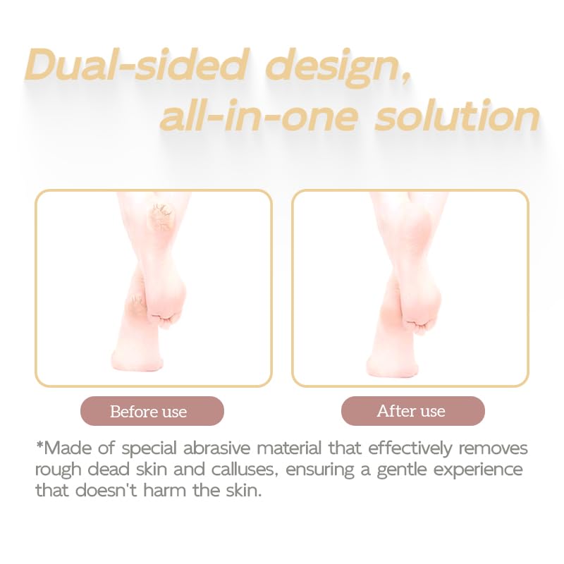2 piezas Lima para Pies Durezas, Lima Pies, Lima Durezas Pies, Lima Doble Cara para Pies Secos y Húmedos, Ideal para Pedicuras en Casa y Profesionales, Elimina Piel Muerta y Dura,Black y Pink