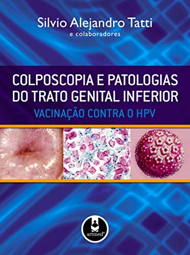Colposcopia e Patologias do Trato Genital Inferior: Vacinação Contra o HPV