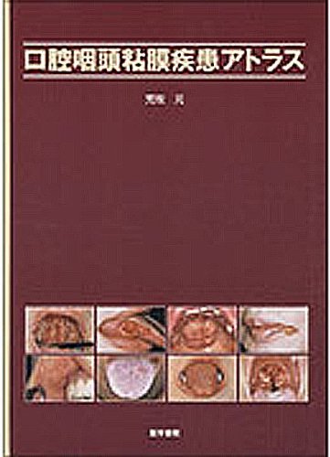 無料電子書籍 pdf 口腔咽頭粘膜疾患アトラス バイ