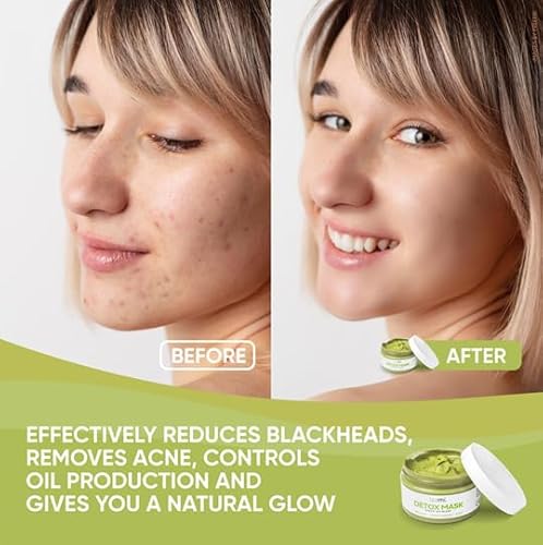 image for Teami Detox Face Mask for Hydraiting, Moisturizing & Purifying, Blackh