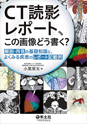無料電子書籍 おすすめ CT読影レポート、この画像どう書く?〜解剖・所見の基礎知識と、よくみ バイ