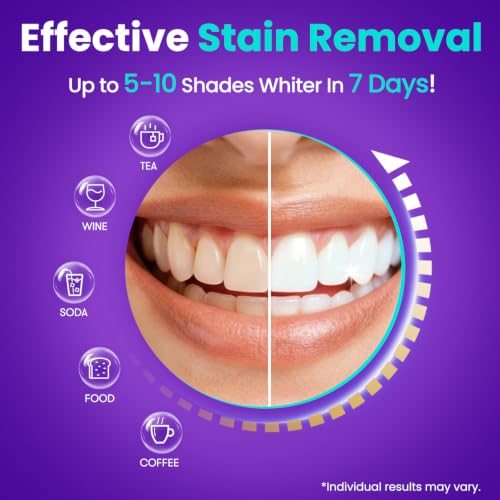 Image of MySmile Teeth Whitening Strips 14 Treatments, Hydroxyapatite-Infused White Strips for Sensitive Teeth, Teeth Whitener with Enamel-Safe Formula, Non-Slip, Residue-Free Whitening Kit, Mint