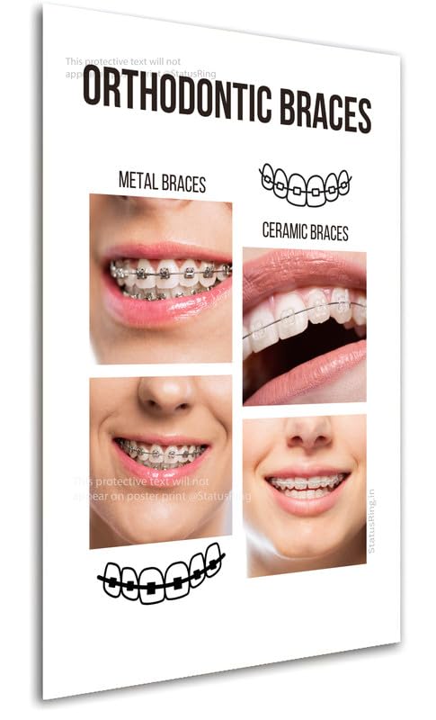 Orthodontics Metal vs Ceramic braces wt Dentist Dental Clinic poster without frame StatusRing-image-36