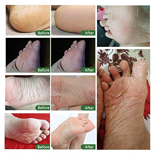 Foot Peel Mask - Exfoliating Foot Care for Soft Feet