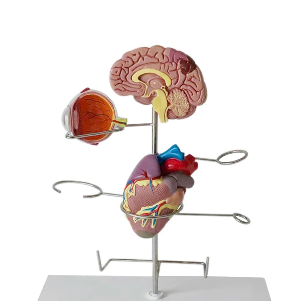 Medyczny Model Cukrzycy, Model Patologii Cukrzycy, Materiał PVC Patologia Cukrzycy Serce, 8 Części Zdejmowany Model Narządu Dla Studentów Anatomii I Fizjologii