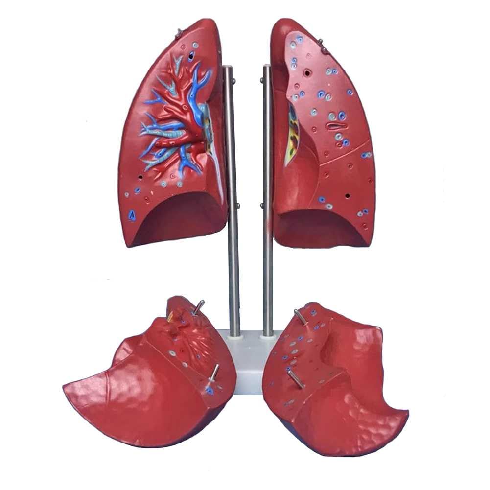 Modèle de poumon humain grandeur nature avec 4 parties amovibles pour anatomie