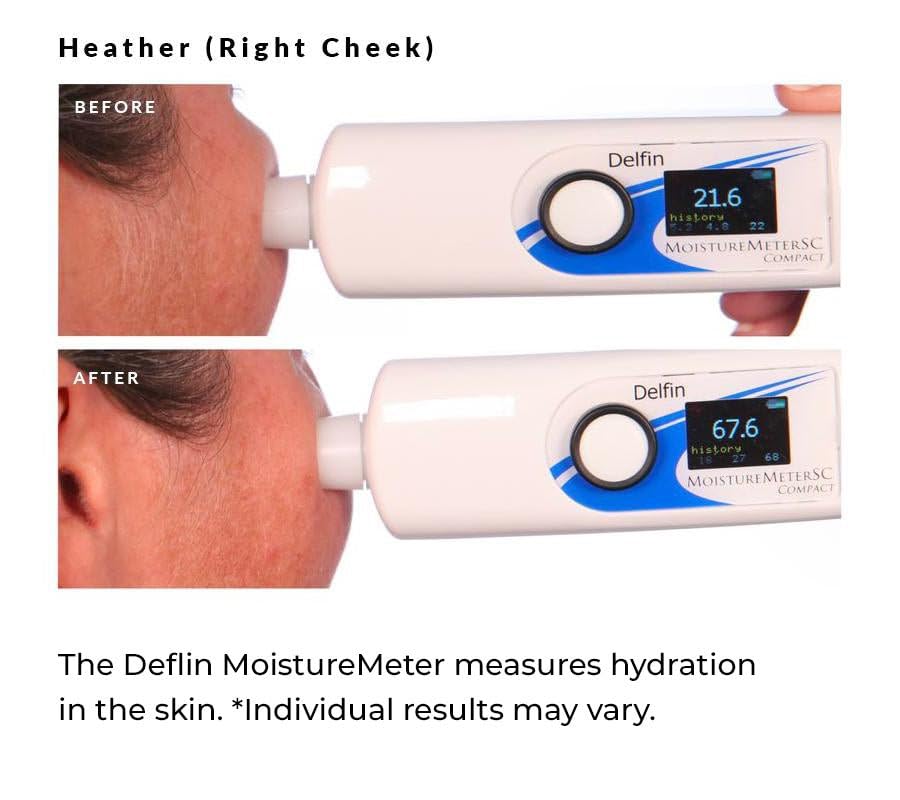 NassifMD 3HA Instant Hydrating Facial Mist - Contains 3 Types of Hyaluronic Acid to Keep Your Face Refreshed and Hydrated, Decreases Look of Skin Puffiness, Dark Circles and Fine Lines