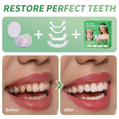 2 Pairs, Adjustable for Men and Women, Regain Confidence Smile, Nature and Comfortable-00Z4