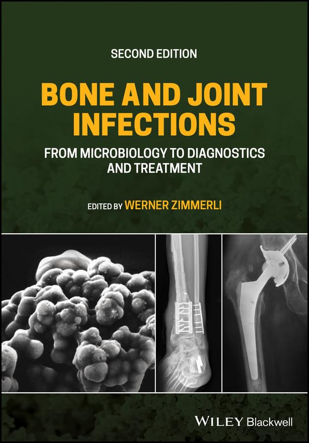 Bone and Joint Infections: From Microbiology to Diagnostics and Treatment      2nd Edition, Kindle Edition