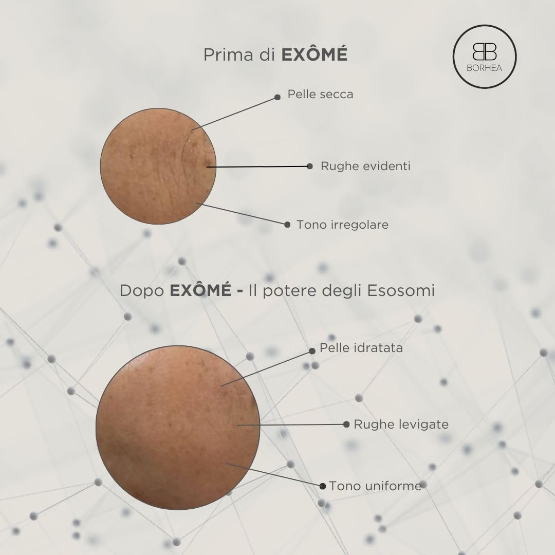 BORHEA EXÔMÉ Fiale Esosomi 10% – Trattamento Urto Professionale per Microneedling e Rigenerazione Totale – Siero Viso Esosomi Antiage Concentrato per Lifting e Macchie, 6x5ml