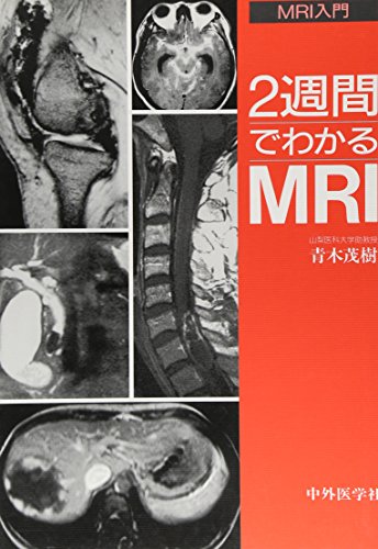 スマホ 無料電子書籍 2週間でわかるMRI―MRI入門 バイ