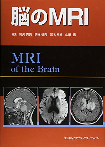 楽天 無料電子書籍 脳のMRI バイ