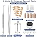 Ingrown Toenail Removal Kit, Professional Ingrown Toenail Tools Set Includes Ingrown Toenail Corrector, Tweezer, 10pcs Corrector Strips, 12pcs Podiatry Toenail Braces and 50pcs Toenail Corrector Patch