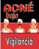  Acné bajo vigilancia: -Controla los síntomas de tu acné a diario gracias a este cuaderno especialmente diseñado / Tratamiento, Dieta, Hábitos, ... dolor.../ 8X10 (20,32X25,40 cm) / 101 páginas