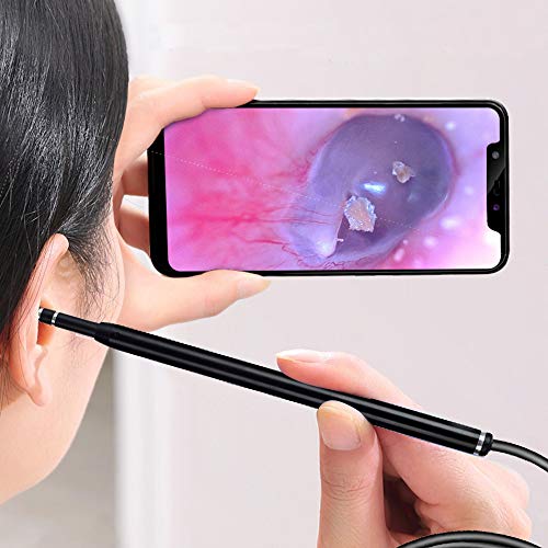 KIICN Câmera de limpeza de orelha, endoscópio de orelha, câmera HD de cera de ouvido 3 em 1, câmera
