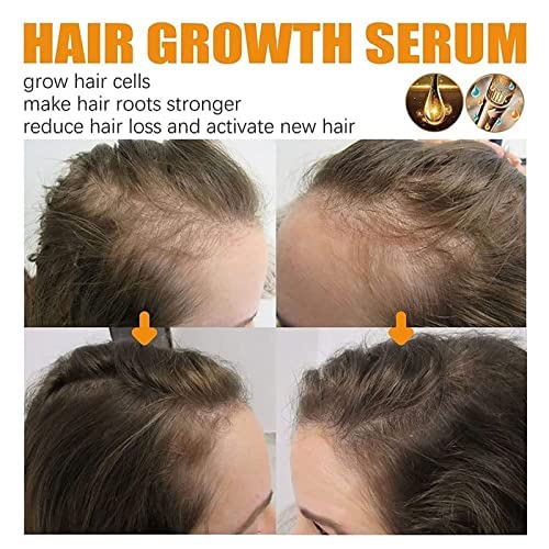Miniatura 3 de Suero para el crecimiento del cabello para mujeres negras, suero de belleza para el cabello, suero de crecimiento del cabello para mujeres negras (3
