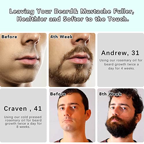 Multipurpose Rosemary Oil For Hair Growth, Eyebrow, Eyelash, Beard& Thinning Hair, Nourish Scalp, Improve Blood Circulation, Hair Loss Treatment, 100% Pure Organic Natural Rosemary Essential Oil #TOP3