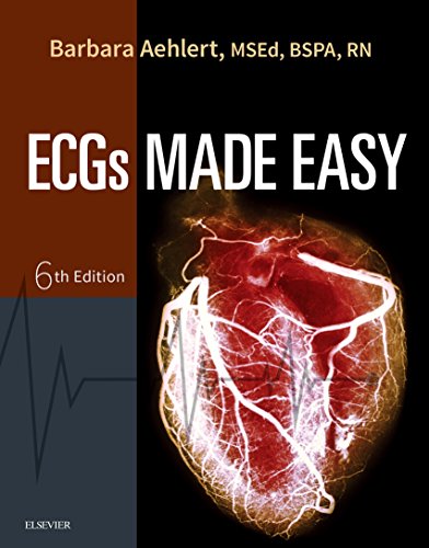 ECGs Made Easy - E-Book ECGs Made Easy - E-Book