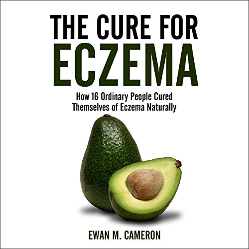 The Cure for Eczema: How 16 Ordinary People Cured Themselves of Eczema Naturally